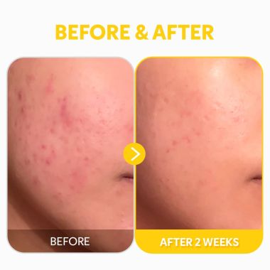 Tirtir: Pure Vitamin C24 Serum 30ml