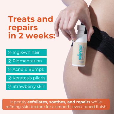 Skinvest: Bye Bye Bumps Exfoliating Mist 50ml | Treats Ingrown hair, Strawberry skin, Razor bumps post waxing/shaving, Acne, Itchiness, Uneven skin texture | All Skin Types - for Men & Women
