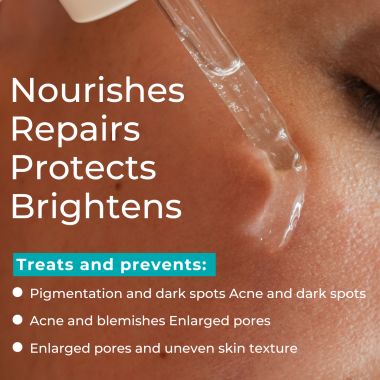 Skinvest: CEO Multi-Active Serum | For all Skin type |  Acne control, skin brightening, texture smoothing, hydration, and barrier repair