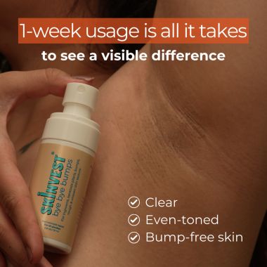 Skinvest: Bye Bye Bumps Exfoliating Mist 50ml | Treats Ingrown hair, Strawberry skin, Razor bumps post waxing/shaving, Acne, Itchiness, Uneven skin texture | All Skin Types - for Men & Women