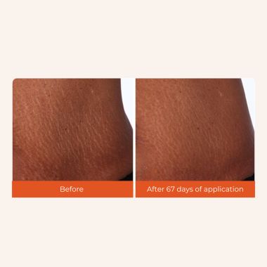 Skinvest: Bomb Bum Cream - 100ml
