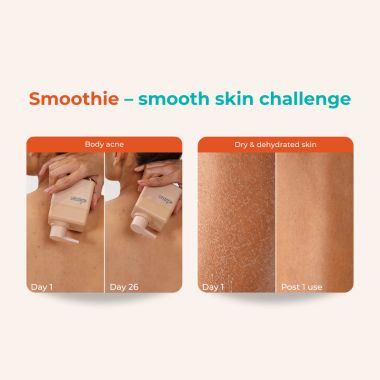 Skinvest: Smoothie In-shower body conditioner - for 24hrs non-sticky Hydration - 150ml | with Shea butter, Salicylic Acid | Reduces Body Acne, Improves Skin Texture, Dryness & Flakiness, Suitable For All Skin Types | For Men & Women | Dermatologist Tested
