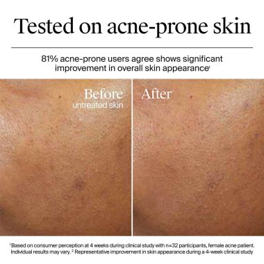 Neutrogena: Hydro Boost Hyaluronic Acid Nourishing Cream 50g