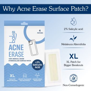 Bake Cosmetics: 2% Salicylic Acid Hydrocolloid Acne Patch XL Pimple Patch-4 Strips