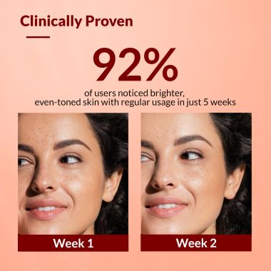 Fixderma
: SKARFIX -TX Face Cream Tranexamic Acid + 2% Kojic Acid - 15gm