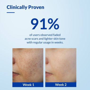 Fixderma: Skarfix -TX Face Cleanser with Tranexamic Acid, Kojic Acid & Niacinamide - 75gm
