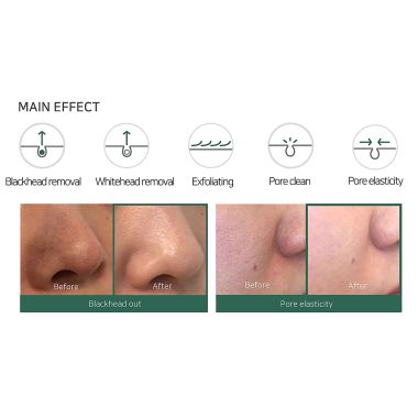 SOME BY MI: Bye Bye Blackhead 30 Days Miracle Green Tea Tox Bubble Cleanser - 120ml