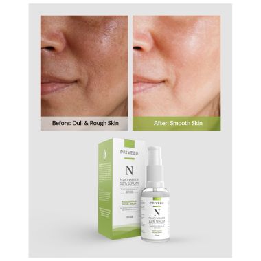 Priveda: Niacinamide Face Serum For Acne Marks And Acne Prone Skin For Men and Women - 30ml