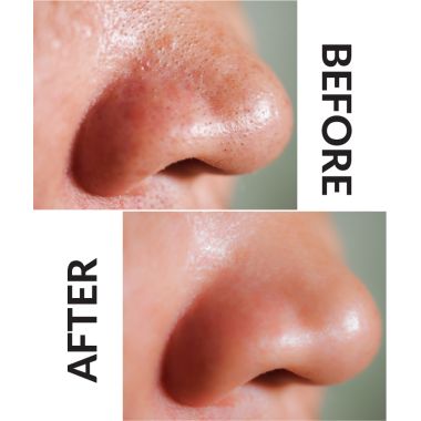 Priveda: Deep Cleansing Charcoal Nose Strip - Pack of 4