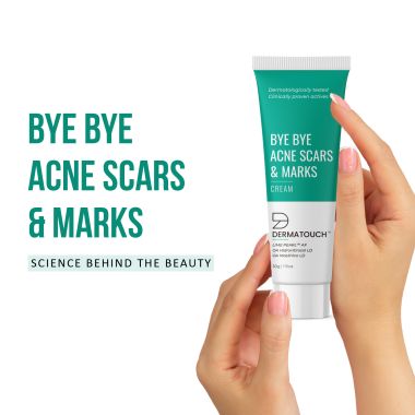 Dermatouch: Bye Bye Acne Scars & Marks Cream - 30gm