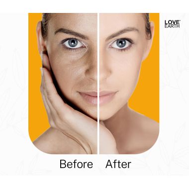 Love Earth: Anti-Blemish & Anti-Pigmentation Cream -50gm