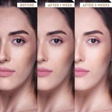 Belora: Skin brightening vitamin c moisturizer - 50gm