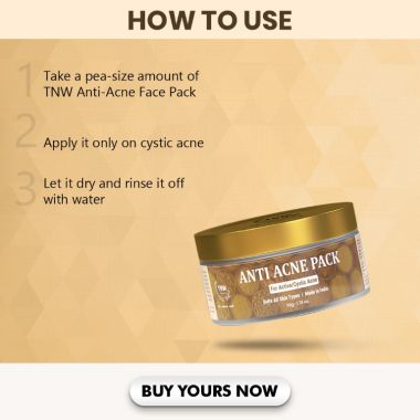 TNW - The Natural Wash: Anti Acne Pack For Active/Cystic Acne - 50gm