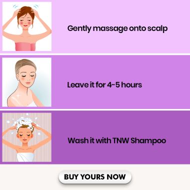 TNW - The Natural Wash: Onion Hair Oil For Faster Hair Growth & Complete Nourishment - 100ml