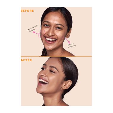 Type Beauty: Zit Quit Concealer, For Acne & Uneven Texture - Frappe - 8Ml