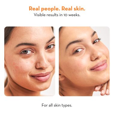 Plush: High on Collagen Gentle Face Wash with Niacinamide - 100ml