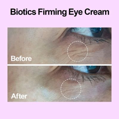 VariHope: Biotics Firming Eye Cream - 20ml