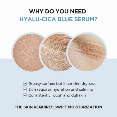 SKIN1004:  Madagascar Centella Hyalu-Cica Blue Serum 50ml