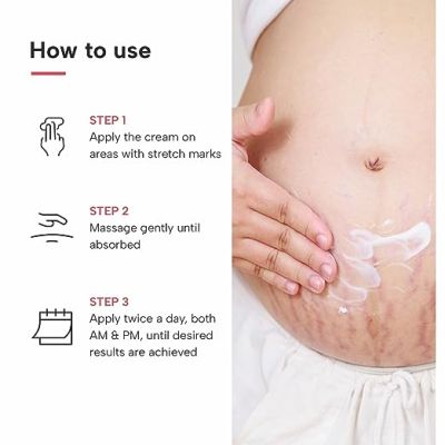 Dermatouch: Bye Bye Stretch Mark Cream - 70gm