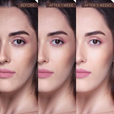 Belora: Serum 24k Gold Advanced ++ (Serum 24 Carats Advance) - 30ml