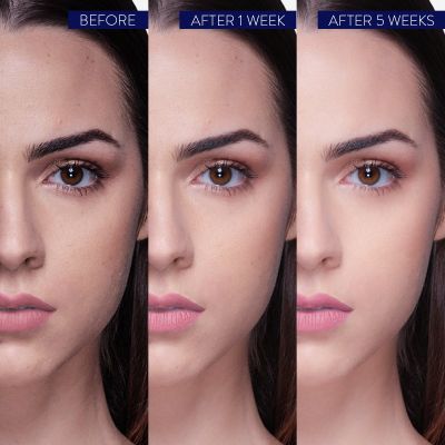 Belora: Serum High Hydration (Serum Haute Hydratation) - 20ml