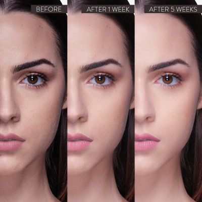 Belora: Serum Better Brightening (Serum Lumineuse) - 30ml