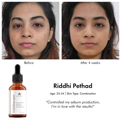 Suganda: 5% Niacinamide Serum - 30ml