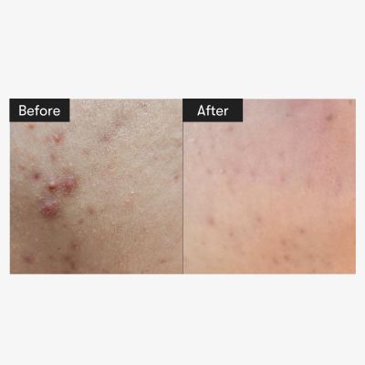 VT Cosmetics: Cica Reedle Shot 300 Essence | 50ml