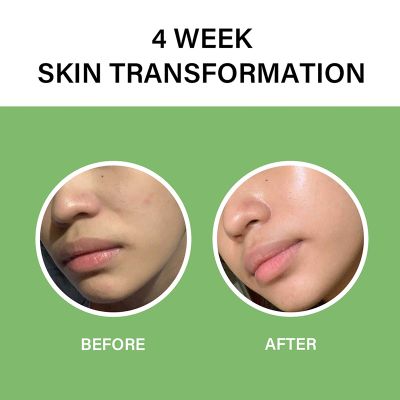 Celimax: The Real Noni Energy Ampoule - 50ml