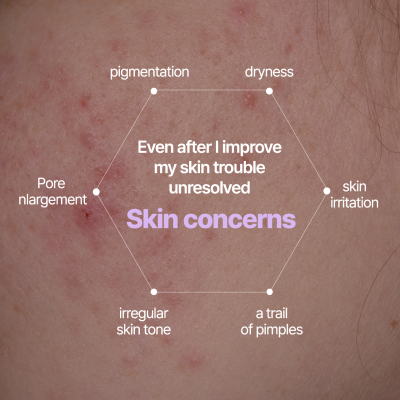 AUIO: Niacinamide 20% + Zinc 1% Serum