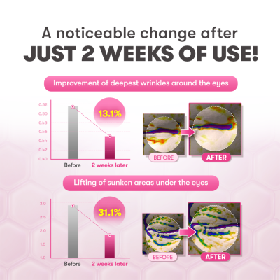 AUIO: Slow- Ageing Needle Age Shot 300 New Packing Green