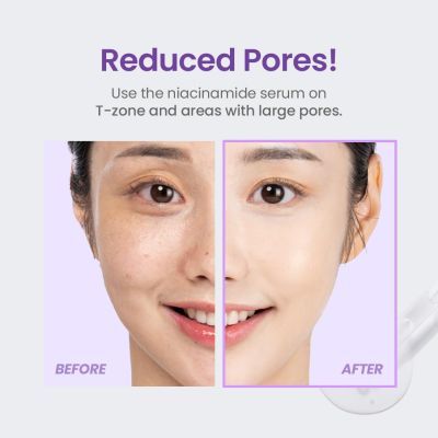 Tirtir: Niacinamide 20% Serum 30ml