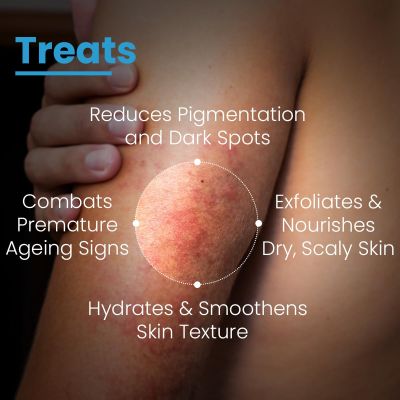 Fixderma Cosmetic Laboratories: Aha Lotion 10 Hydrates Skin And Softens Dryness - 100ml