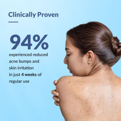 Fixderma: 2% Salicylic Acid Salyzap Body Acne Spray  -  50ml