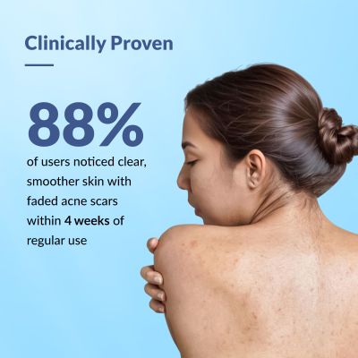 Fixderma: Salyzap Body Wash 2% Salicylic Acid For Acne Clean Pores Suitable - 100ml