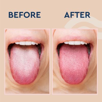 GUBB: Tongue Cleaner Copper (Round)