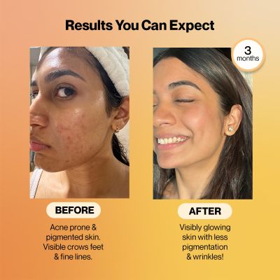 SETU: Radiant Skin Combo- 8g Marine Collagen + Ceramosides- 300gm & 8-in-1 Glutathione Fizzy 30 Tabs, Reduces Hyperpigmentation, Wrinkles, Fine Lines & Supports Supplement, Healthy Skin for Men & Women