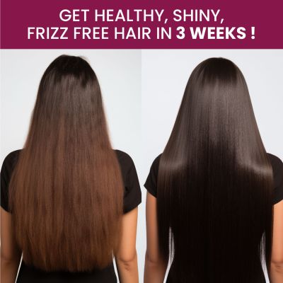 Vlado's Himalayan Organics: Biotin 10000Mcg High Potency For Healthy Hair And Skin - 120 Tablets