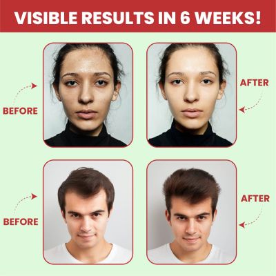 Vlado's Himalayan Organics: Vegan Collagen supplements - Advanced Marine Collagen Peptides - 100gm ( Watermelon Flavor )