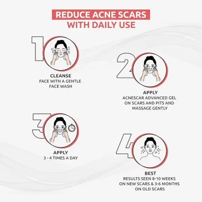 Brinton : Acnescar Gel  15gm
