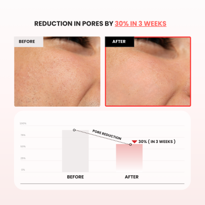 Mirabelle: Red Rice Refresh Water Toner