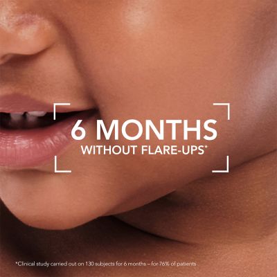 Bioderma: Atoderm Intensive Baume Ultra-soothing Balm Very dry, Sensitive to Atopic Skin, 200ml