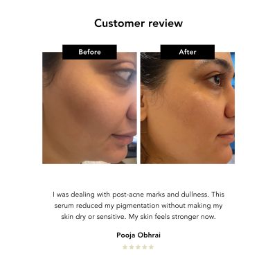NERAH Skin: Kudzu Restoring Serum   30ml