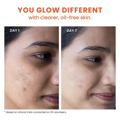 Foxtale: True Clarity Oil And Acne Control Face Wash  150ml