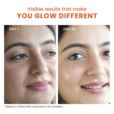 Foxtale: The Dazzler Multivitamin Glow Toner + Makeup Setting Spray   150ml