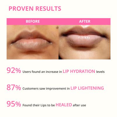 ALANNA: Lemon Lip Balm - 8 gm