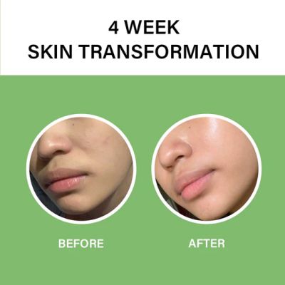 Celimax: The Real Noni Energy Ampoule - 40ml