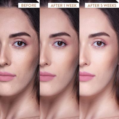 Belora: Skin brightening vitamin c moisturizer - 50gm