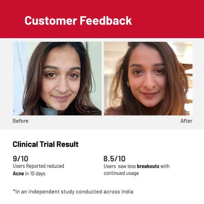 Chemist at Play: Acne Control Face Serum with Ceramides for All Skin Types 10% Azelaic Acid, 10% Niacinamide - 30ml