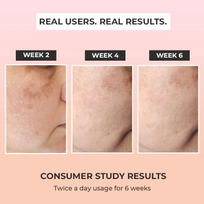The Pink Foundry: Dark Spot & Hyperpigmentation Correcting Power Serum - 30 ml